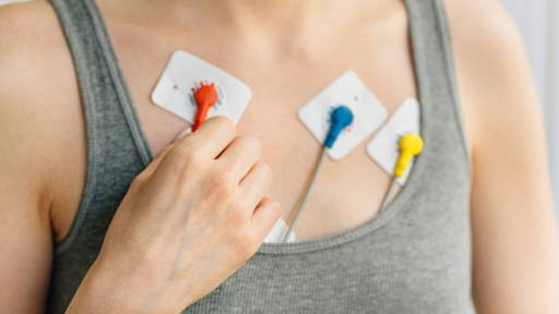 Self-adhesive ECG patch improves comfort and signal quality