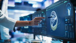 AI diagnosticeert hersentumor in minuten