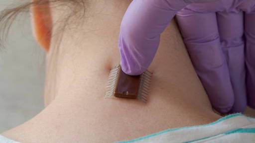 ‘Cyborg’-organoïde als mogelijke doorbraak in diabeteszorg