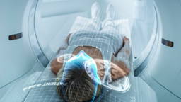 3D-geprinte hersensensoren voor betere monitoring