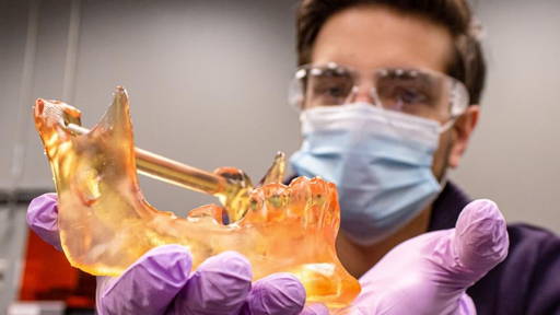 Personalized 3D models sharpen precision in oral cancer surgery