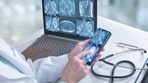 AI op zoek naar manier om voorbij de  belofte te komen