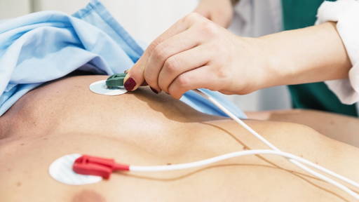 AI-model spoort prediabetes op via ECG, zonder bloedtest