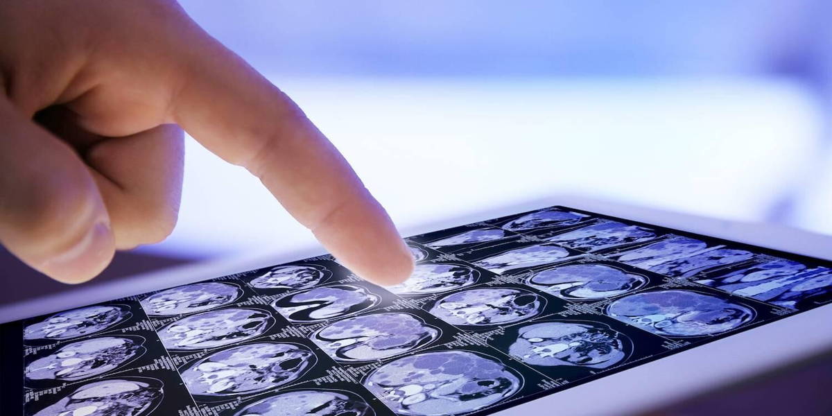 AI in topklinische en algemene ziekenhuizen: de stand van zaken