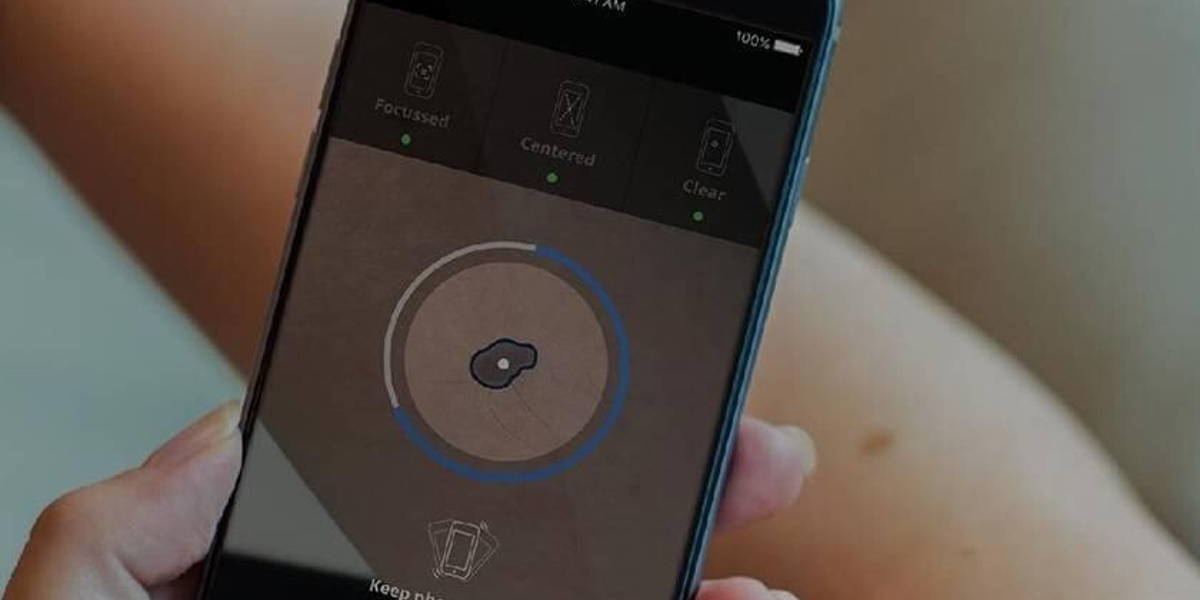 SkinVision-Skin-Cancer-Melanoma-Detection-App