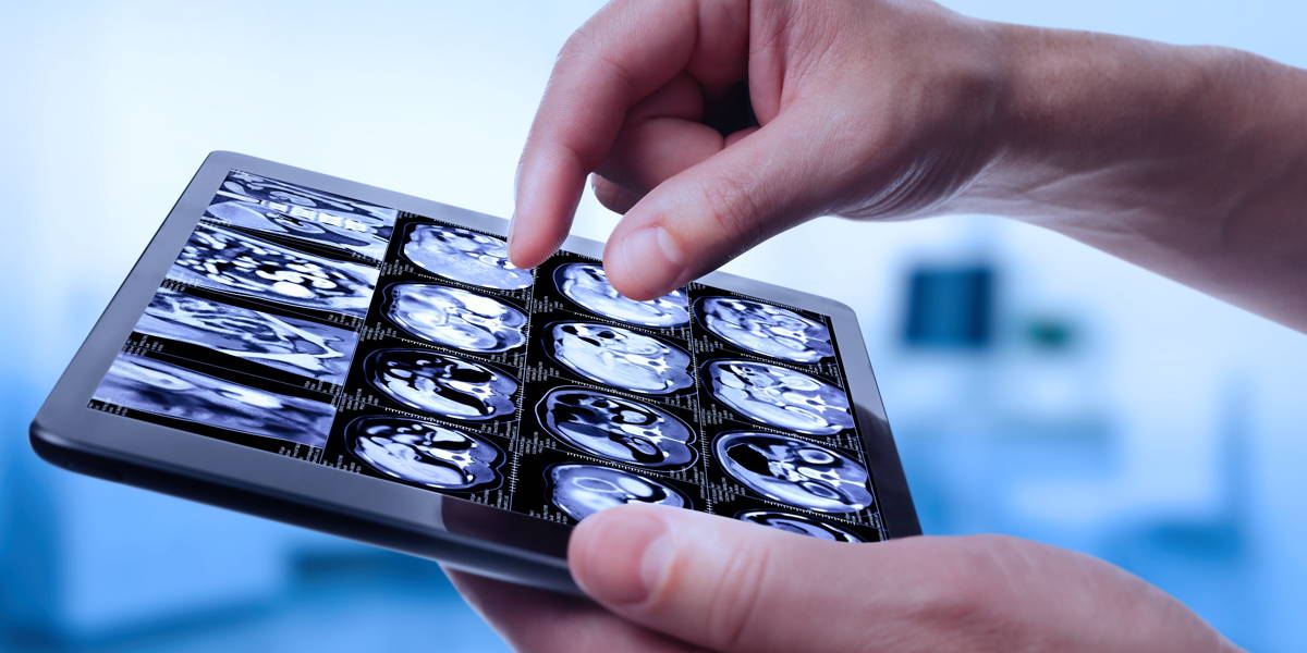 Amsterdam UMC: beeldbeschikbaarheid straks landelijk mogelijk via XDS