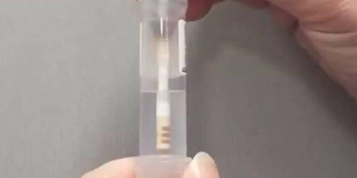 Zelftest-Darmziekte-UMCG-e1631728622686