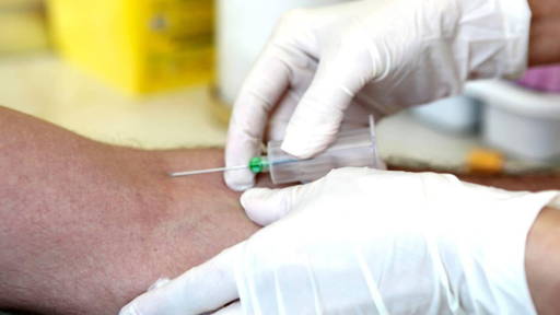 AI-bloedtest detecteert alvleesklierkanker in vroeg stadium