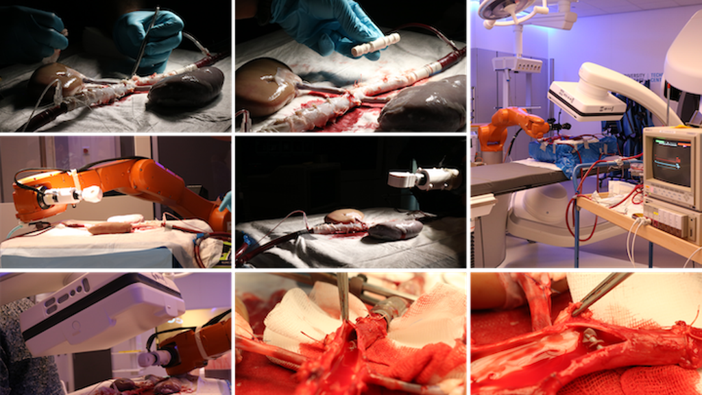 Straks kunnen wij elk onderdeel van het lichaam bereiken