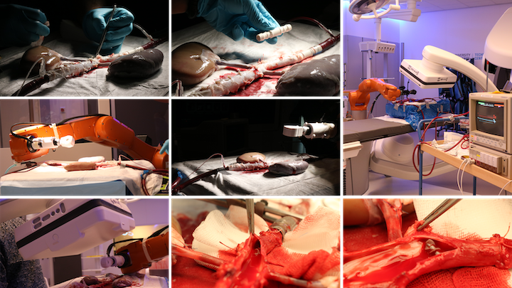 Straks kunnen wij elk onderdeel van het lichaam bereiken